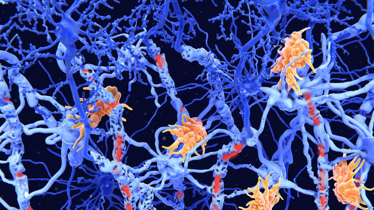 Una investigadora española firma en Nature un avance contra el Alzheimer, el Parkinson y la esclerosis múltiple: la inflamación cerebral es también el primer paso de la reparación
