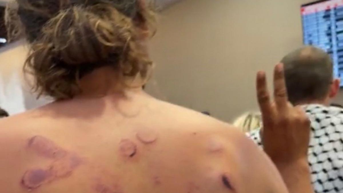 Las imágenes de las torturas de Israel a los activistas de la Flotilla: 