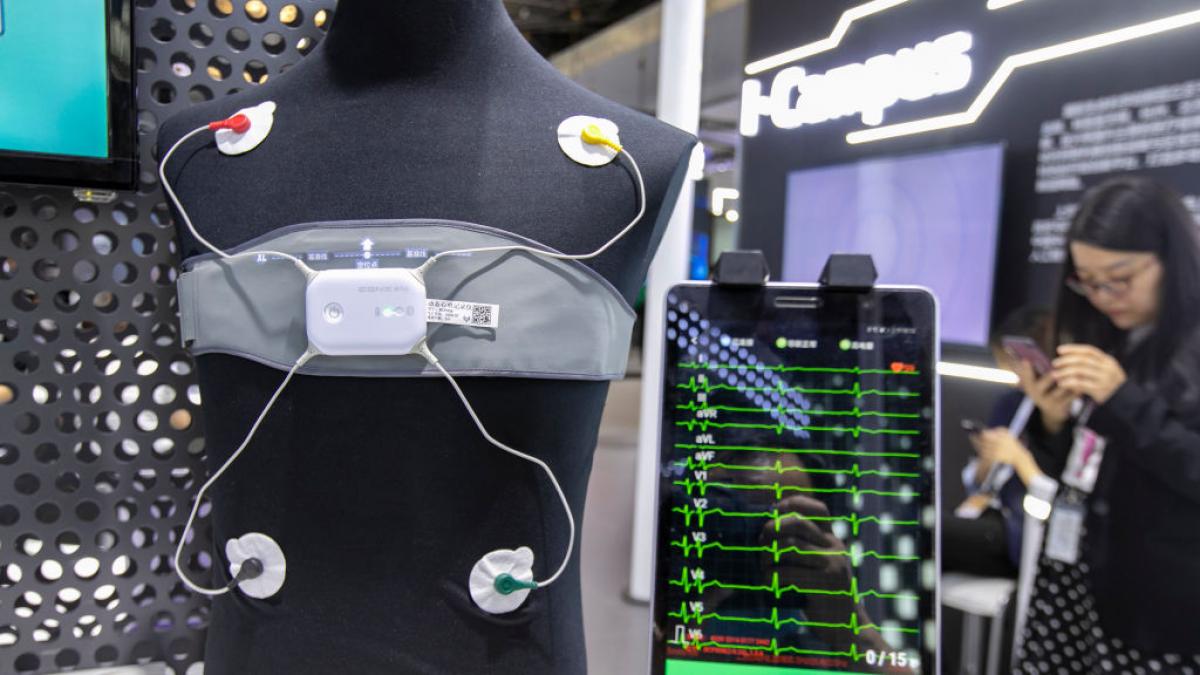 El electrocardiograma lleva un siglo sin detectar la insuficiencia cardiaca: una IA la encuentra en menos de dos segundos