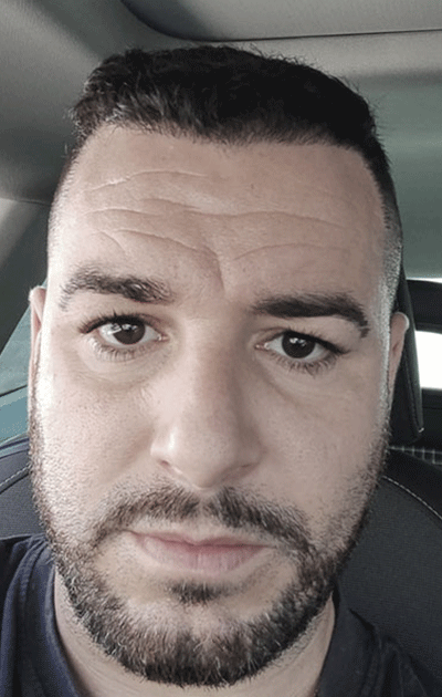 Entre los cuatro y los seis meses se comienza a ver un crecimiento más significativo del cabello.